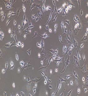 基因編輯T淋巴細(xì)胞的未來(lái)之路