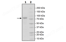 ROR2, Fc-Fusion (IgG1), Avi-Tag, Biotin-Labeled HiP™ Recombinant