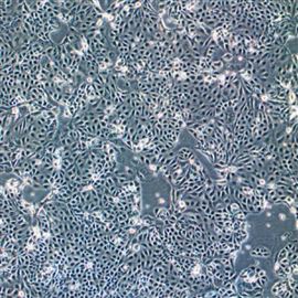 人膀胱癌細胞HT-1197(STR鑒定正確)