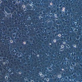 人口底鱗癌細胞UM-SCC-1(STR鑒定正確)