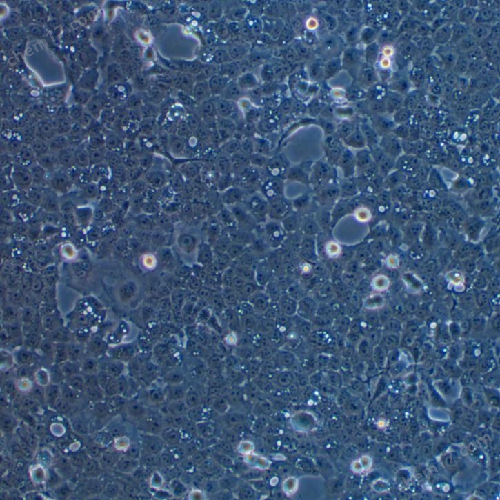 人口底鱗癌細胞UM-SCC-1(STR鑒定正確)