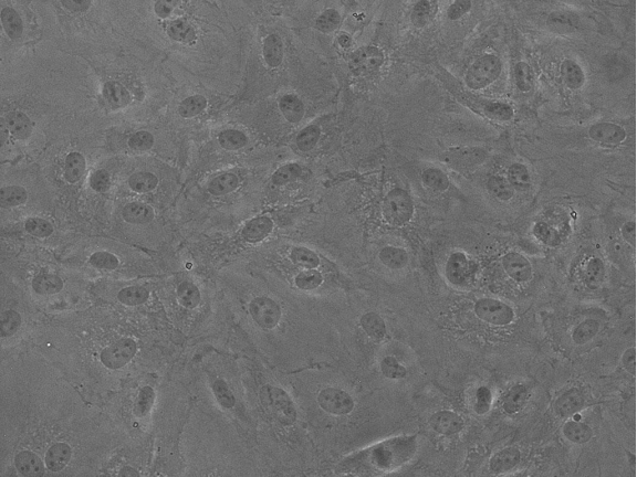 LONZA原代人主动脉内皮细胞HAEC, Human Aortic Endothelial Cells产品介绍