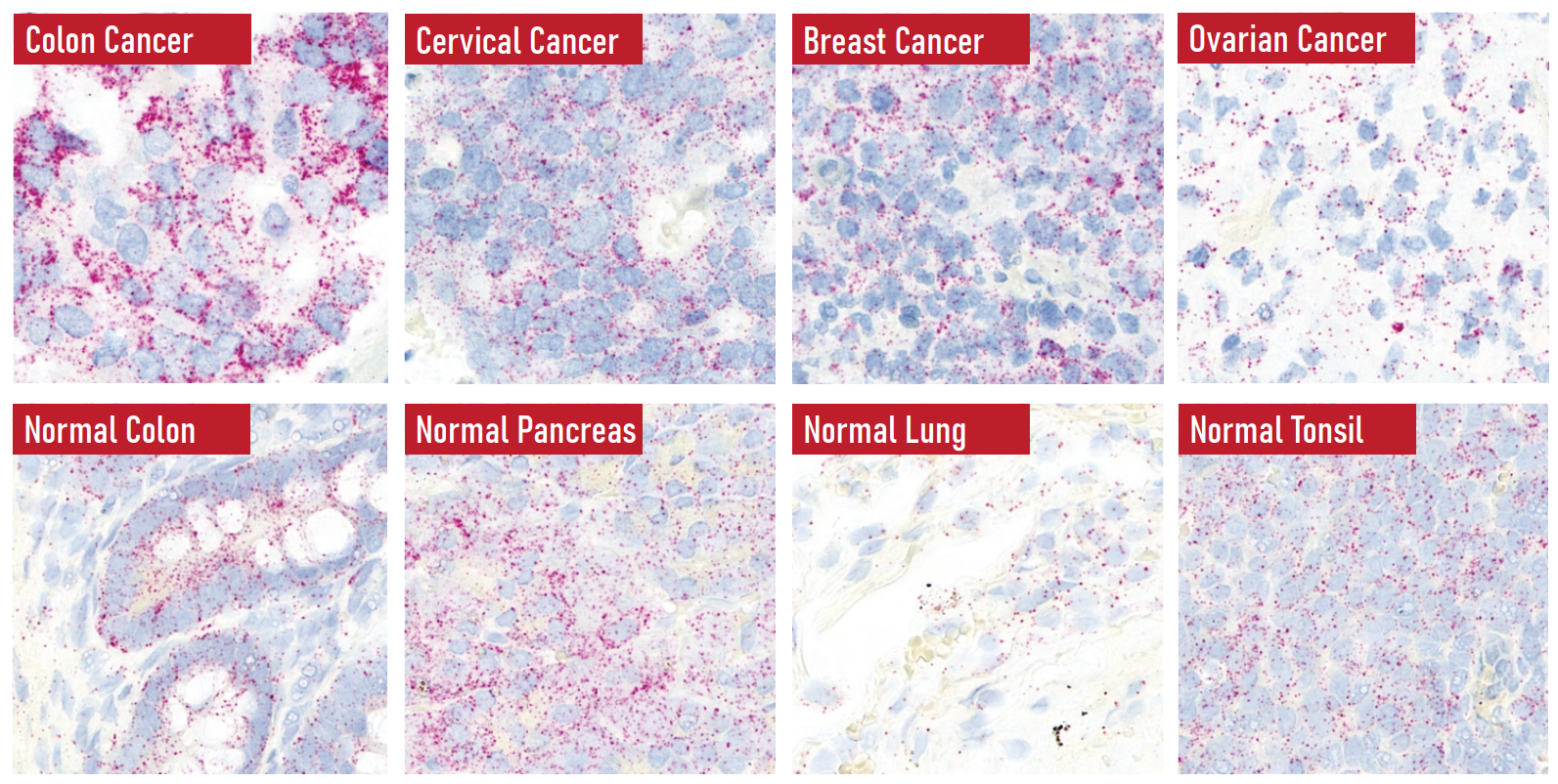 image.png Biochain公司Acepix Bio核糖核酸原位杂交验证福尔马林固定石蜡包埋组织手册